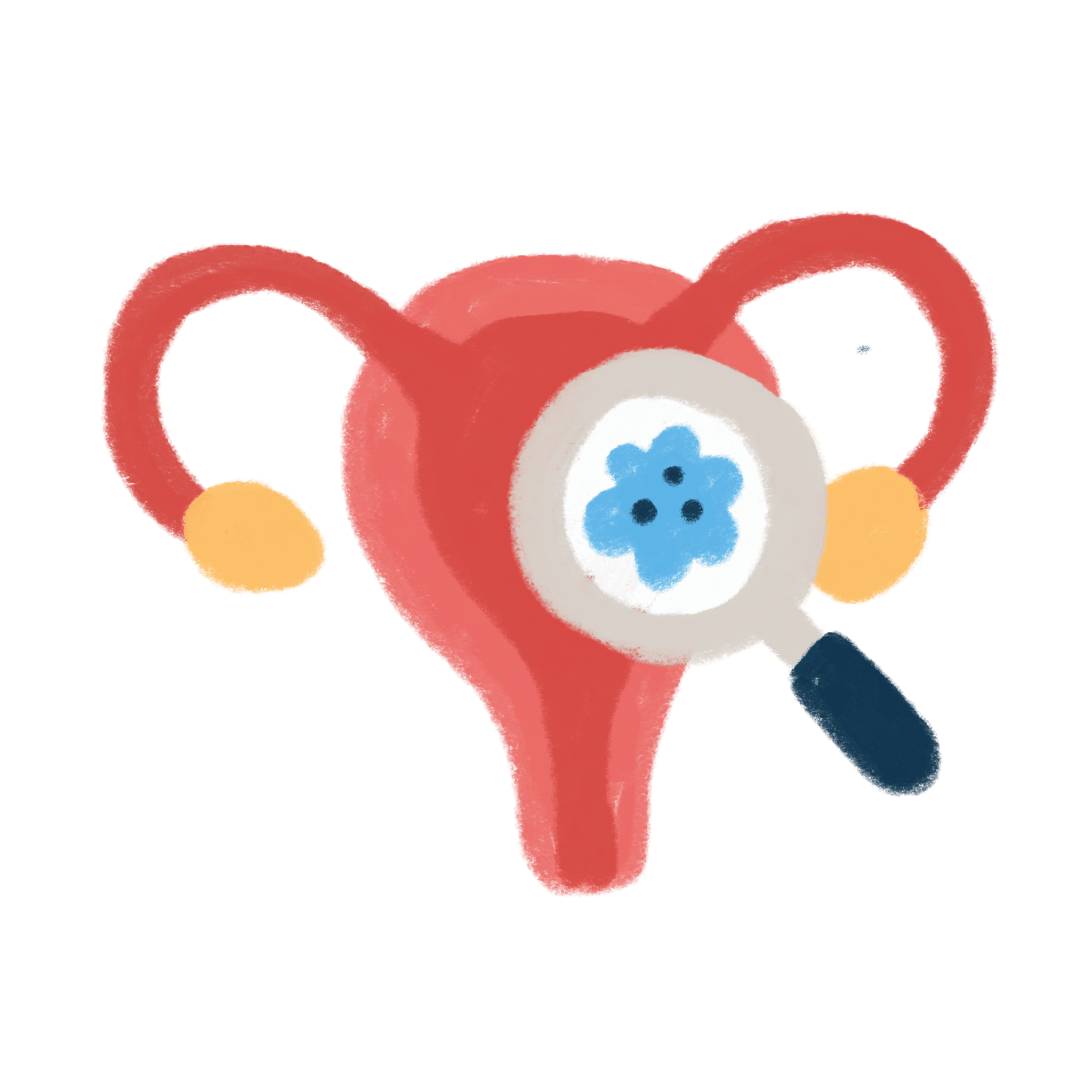 cancer screening and prevention